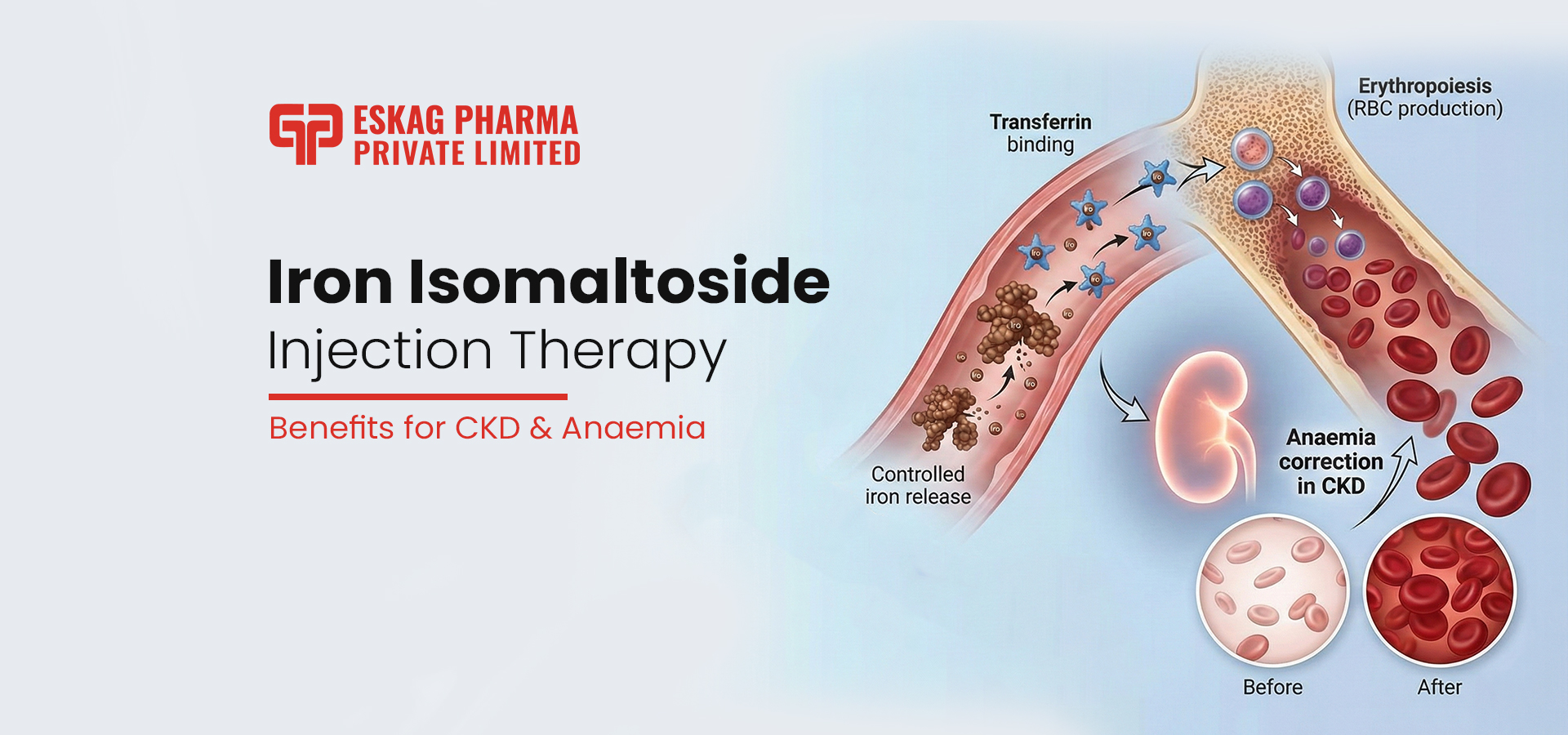 Iron Isomaltoside Injection Therapy for CKD & Anaemia