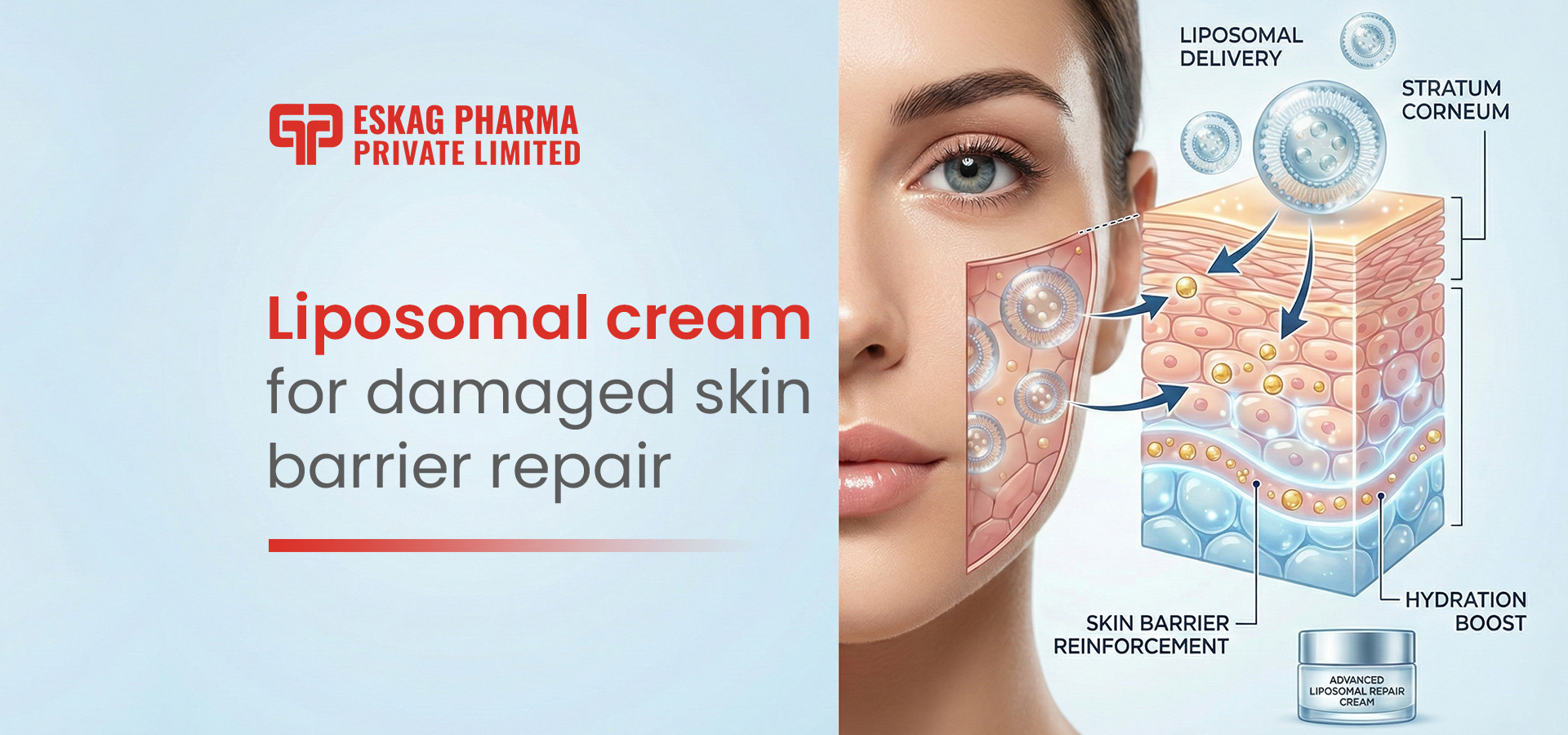 Liposomal cream for damaged skin barrier repair